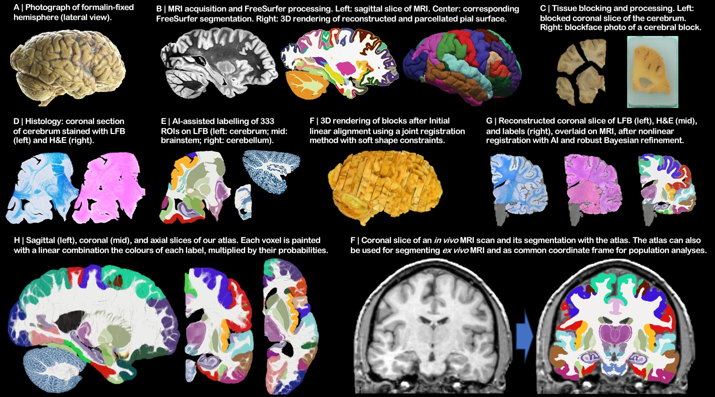 New brain atlas